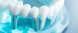 Dental City | Especialidades dentales